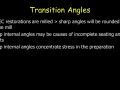 CEREC Preparations - Onlays - Transition Angles