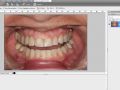 Smile Design - Photoshop Layers
