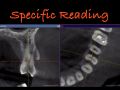 Specific CBCT Reading With The GPS Method