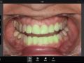 3. iPad Pro Photoshop Fix - Whitening Teeth